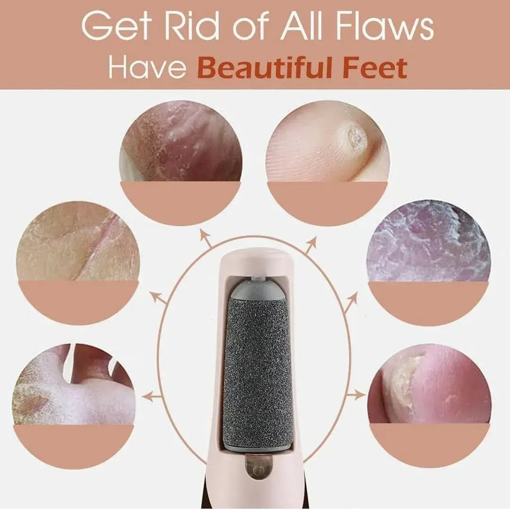 Rechargeable Electric Foot File Callus Remover