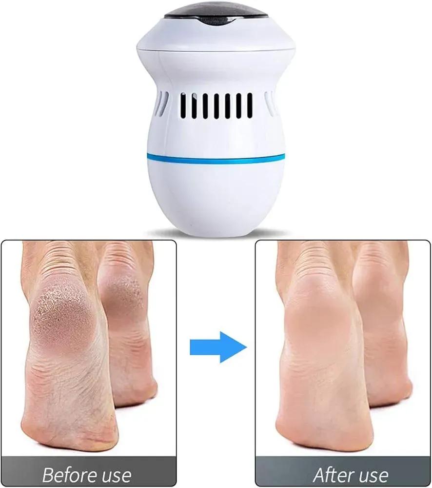 Electric Foot Exfoliator ABS Plastic Home Use
